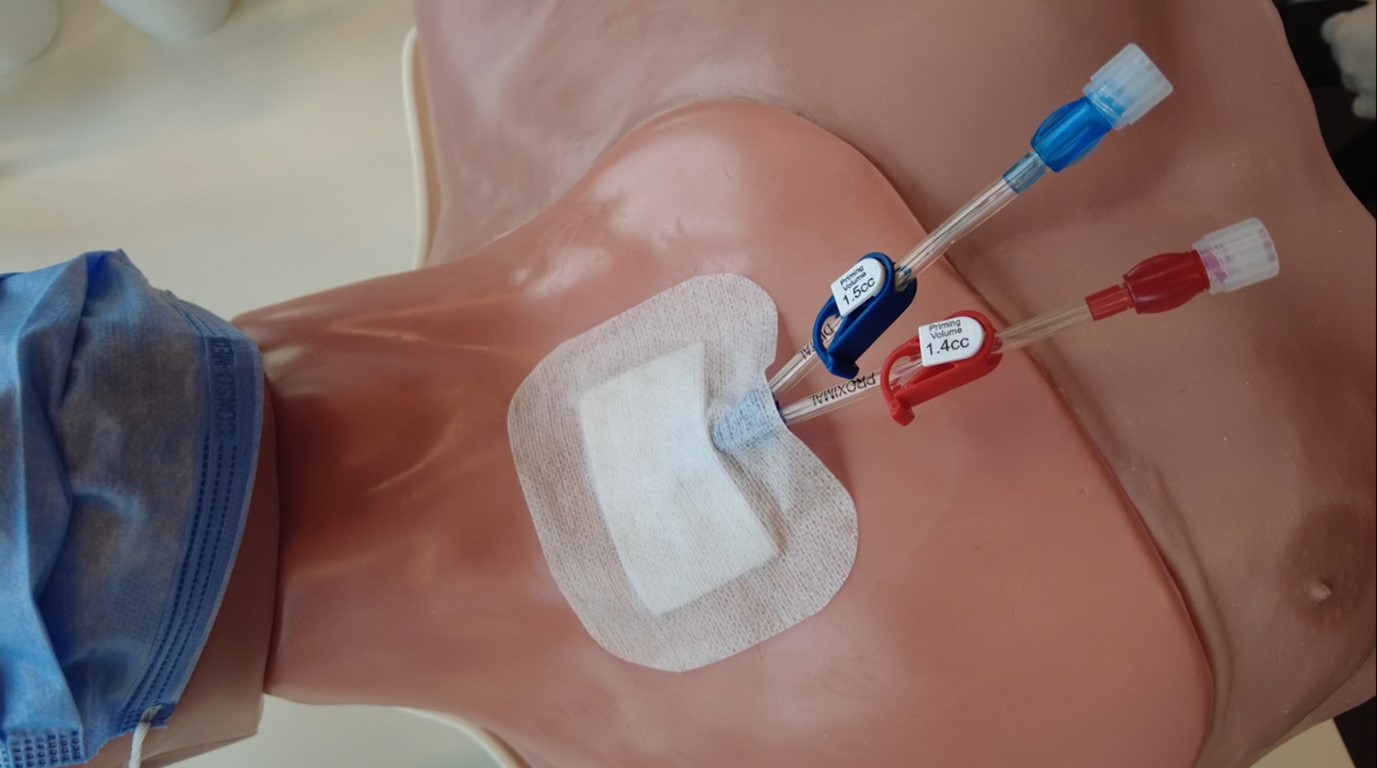 Central Venous Catheter Management 