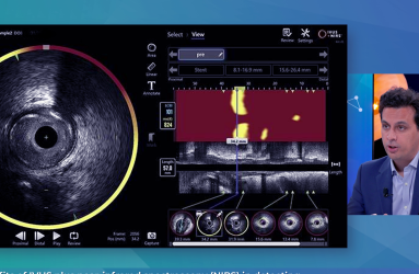 EuroPCR2025_Benefits_of_IVUS